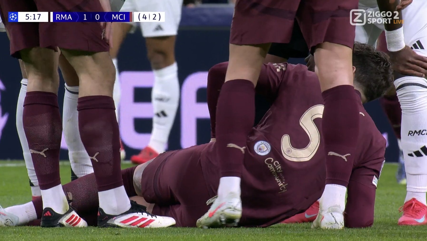  曼城再遭打擊！斯通斯8分鐘傷退，曼城換上阿克