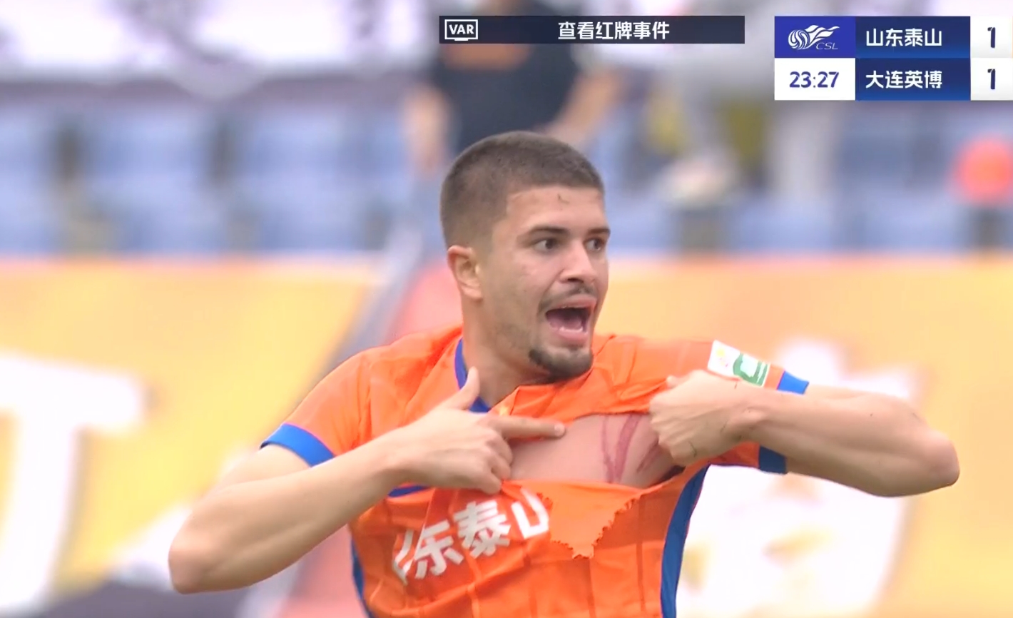  大連少打一人！卡蘭加蹬踏直紅，卡扎爾球衣被蹬爛+胸部三道血痕