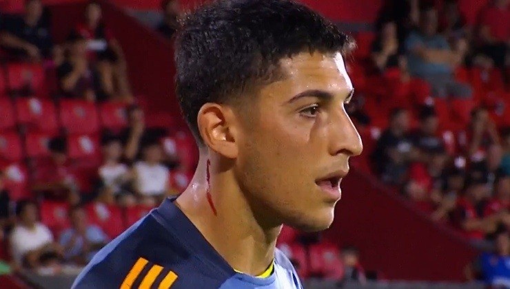  博卡門將被對方球迷丟下的玻璃劃傷脖子后流血，但他仍照常熱身